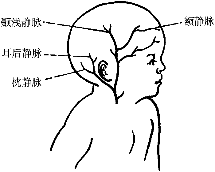 第一節(jié) 靜脈輸液法